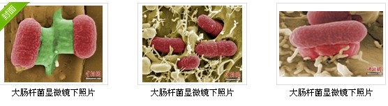 德国公布致命大肠杆菌显微镜下照片